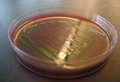 e coli photo
